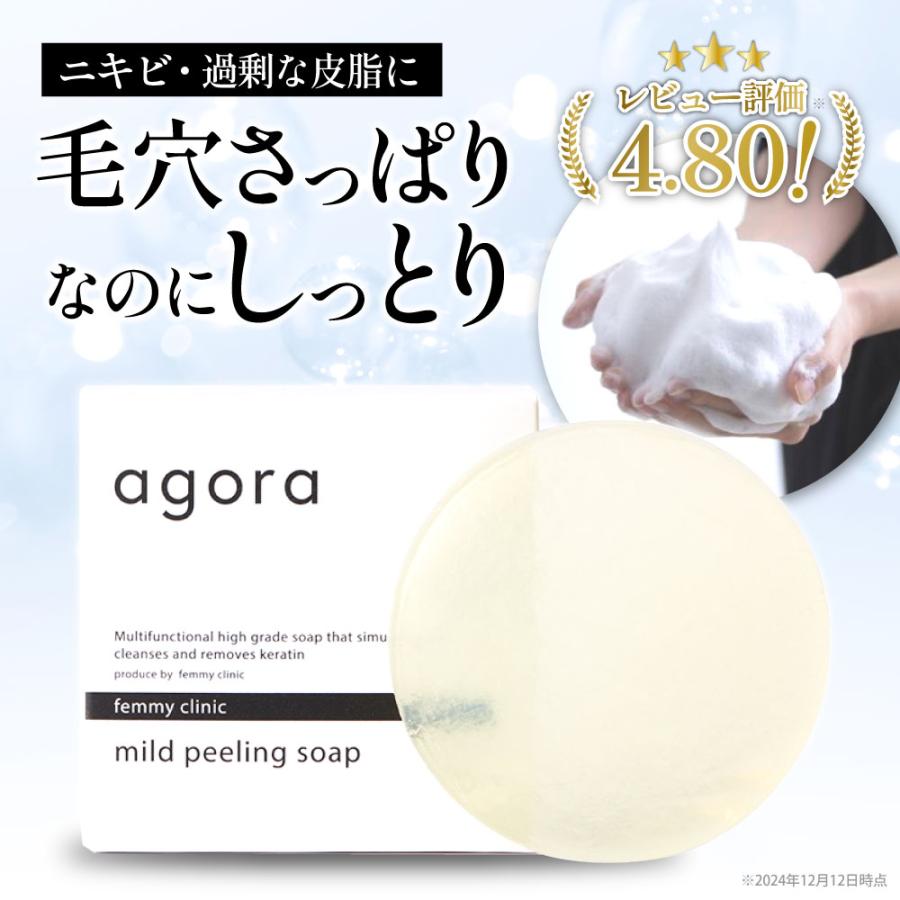 ピーリング石鹸 洗顔石鹸 agora ニキビ